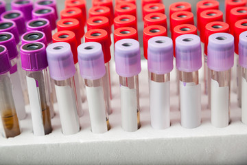 Rack Of Test Tubes