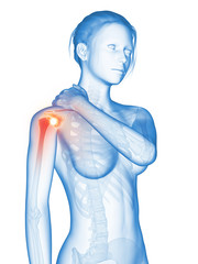 medical 3d illustration - woman having a painful shoulder