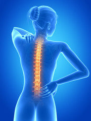 medical 3d illustration - female having backache