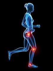 medical 3d illustration - painful leg joints