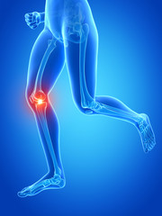 medical 3d illustration - jogger´s painful knee