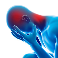 medical 3d illustration - male having a headache