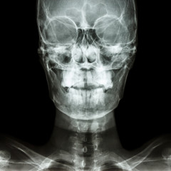 normal human's skull and blank area at right side