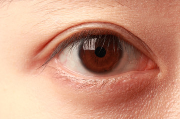 Eye