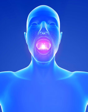 Mal di gola infiammazione arrossamento dolore bruciore