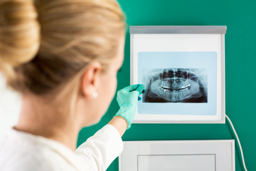 Dentist Doctor with x-ray image