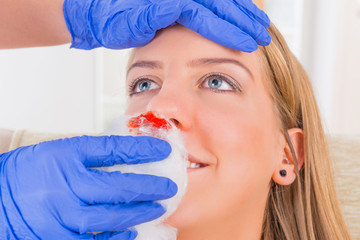 Bleeding nose emergency