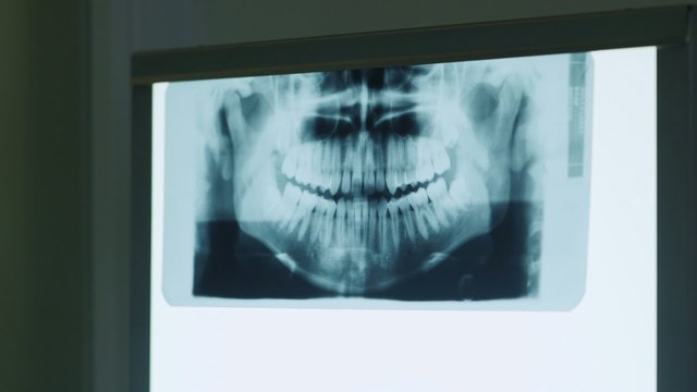 3of3 dentist looking at xray image in dental studio