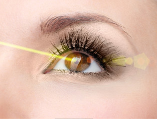 Laser vision correction. Woman's  eye.