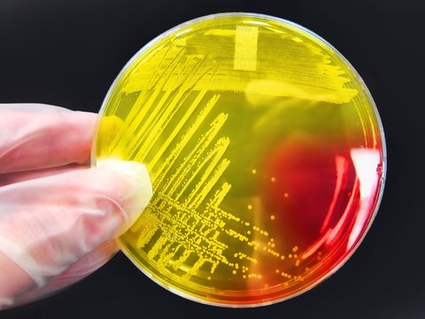 Bacterial pathogen colony on agar streak plate science lab