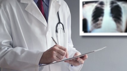 Male doctor examining an x-ray image of lungs - Powered by Adobe