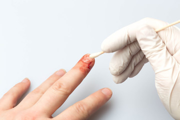 Reinigung Schnittverletzung Finger