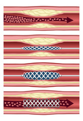 Implanting artery stent in four steps
