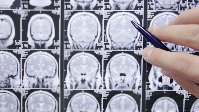 Doctor analyzes results of a magnetic tomography.