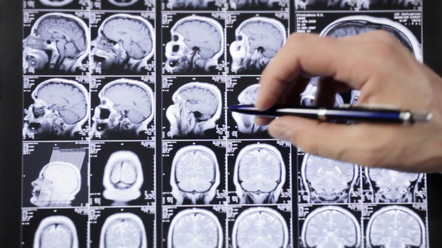 Pathology search. Computed tomography.