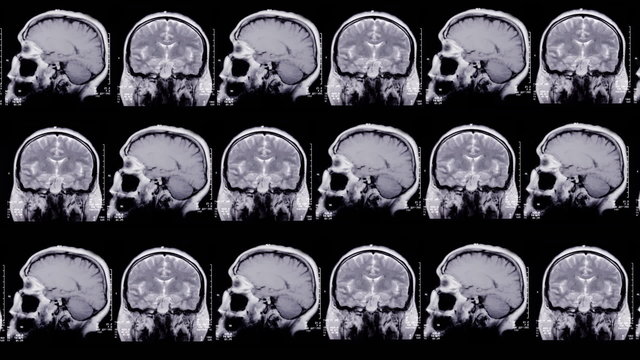 Magnetic resonance imaging. Human brain. Animated background.