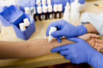 Allergy - skin prick tests - 61798740