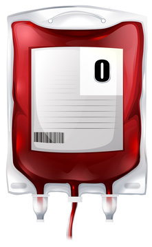 A blood bag with type O blood