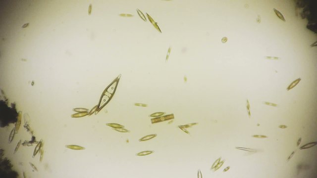 Mikroorganismen unter dem Mikroskop in Full HD