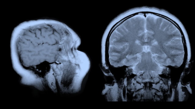 Computed tomography of the human brain. Animated background