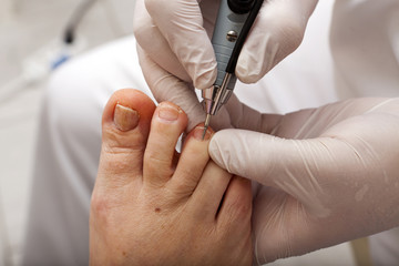 Nagelbehandlung bei einem Fußpfleger