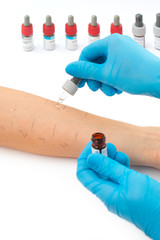 doing a skin prick allergy test