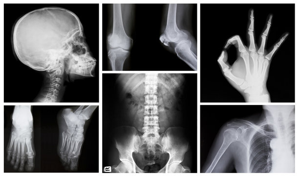 collection of x-ray