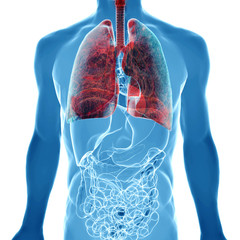 lung cancer in x-ray view - 62310398