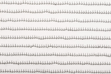 Normal Electrocardiogram Record On Paper