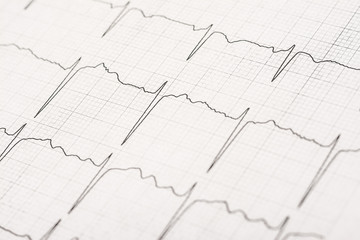 Normal Electrocardiogram Record On Paper