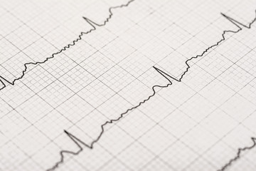 Normal Electrocardiogram Record On Paper