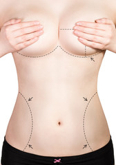 Woman marked out for cosmetic surgery. Isolated on white.