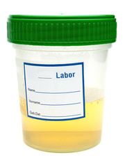 Urinprobe