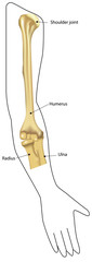 Arthritis Joint Elbow in Situ