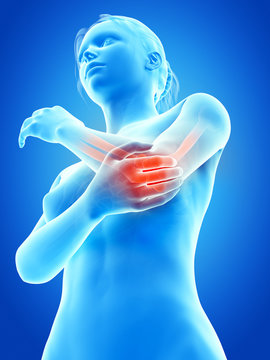 woman having acute pain in the elbow joint