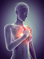 medical illustration - woman having a heart attack