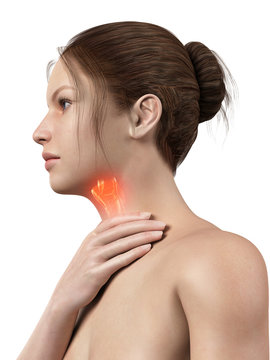 medical illustration of a female with an inflamed larynx