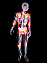 Anatomie - Gelenkschmerzen