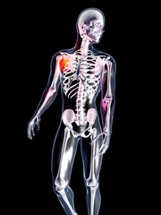 Anatomie - Schulterschmerzen