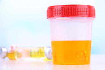 Medical urine test, close-up
