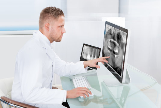 Doctor or radiologist looking at an x-ray online