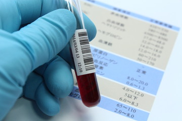 血液検査イメージ