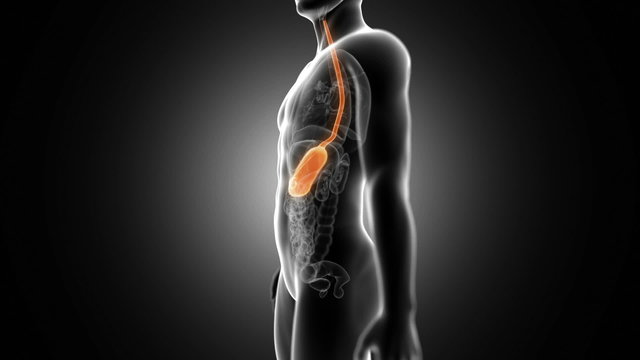 medical animation of the