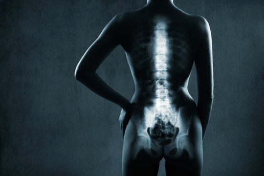 Human backbone in x-ray