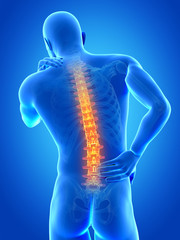 a man having acute pain in the back