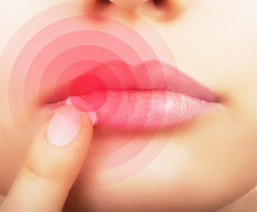 Woman applying cream on lips affected by herpes, shown red.