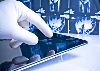 hand touching modern digital tablet on x-ray images - obrazy, fototapety, plakaty