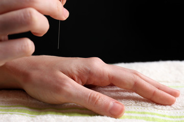 Acupuncture on hand, close up, on dark background