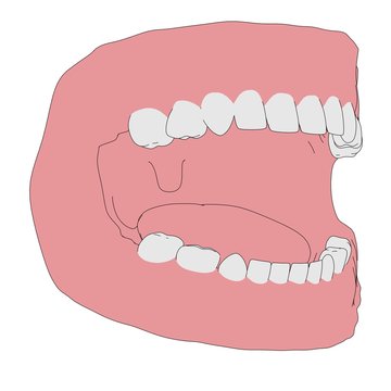cartoon image of child teeth