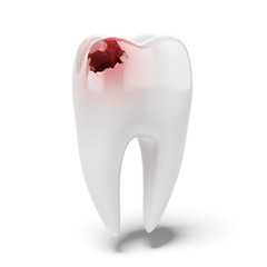 Aching tooth